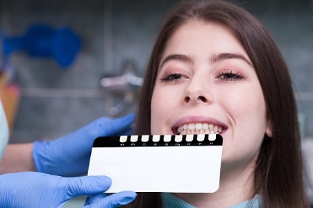 Cosmetic Dental Treatment at Brentwood for Discolored Teeth