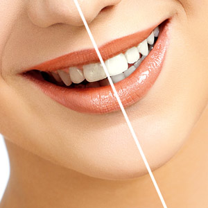 Cosmetic dental surgery available in Brentwood