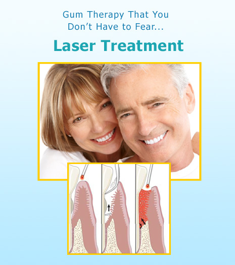 LANAP Laser Treatment Brentwood - Gum therapy Laser Treatment
