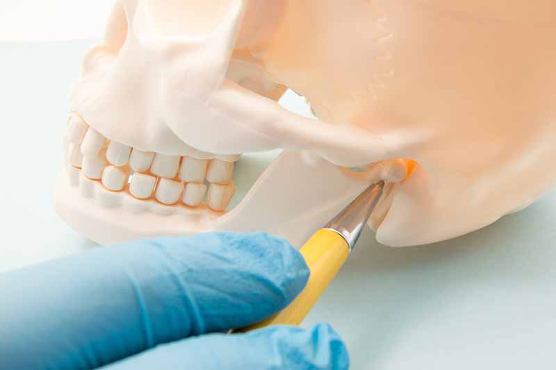 TMJ disorder (TMD) refers to problems associated with the jaw joint, muscles, and tissue that are responsible for moving the jaw.